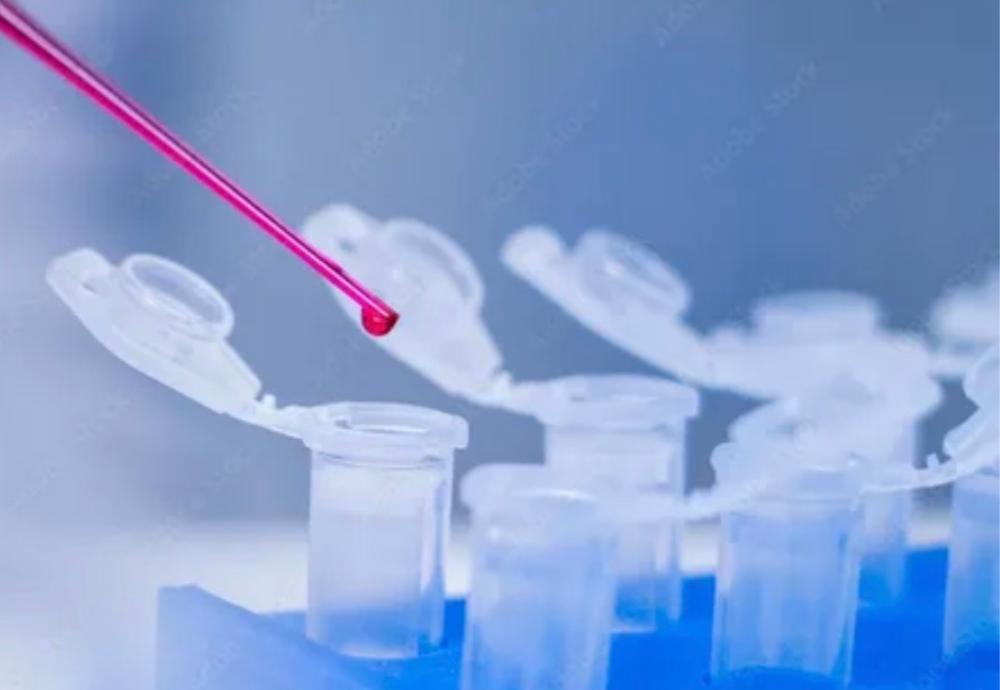 В неделю сохранения мужского здоровья рассказываем как правильно подготовиться к обследованию на ИППП